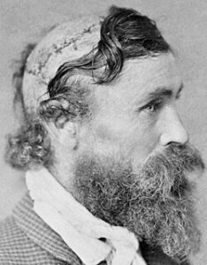 Scalped Alive at 13: The Brutal Reality of Frontier Raids
